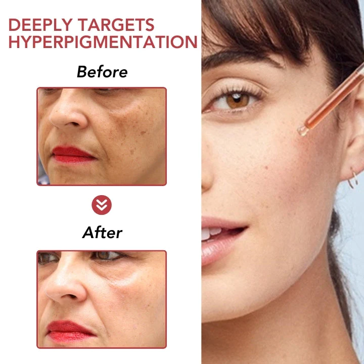 Fivfivgo™ Dunkler Fleck Niacin 10% Korrigierendes Serum - Image 4