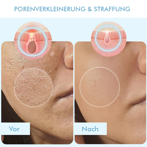 Fivfivgo™ Koreanische Bio-Kollagen Echt Tiefenmaske - Image 9