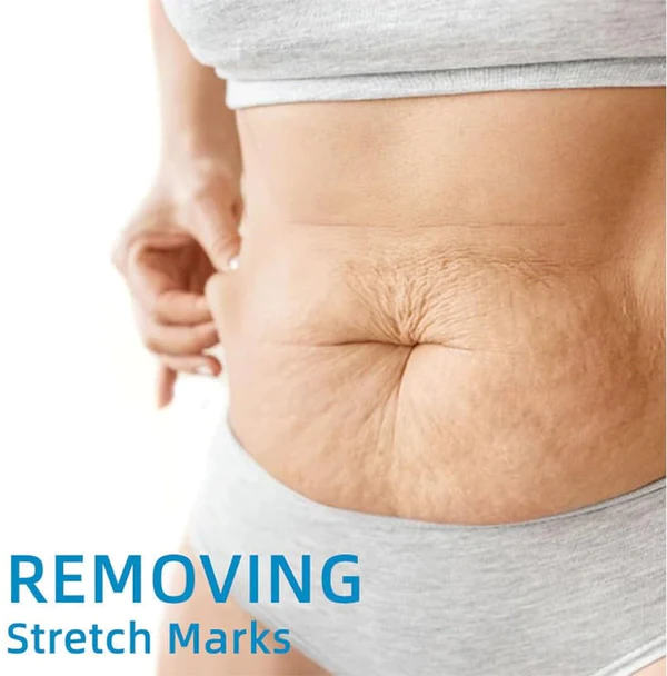 Fivfivgo™ Kollagen-Körperstraffungsöl - Image 4