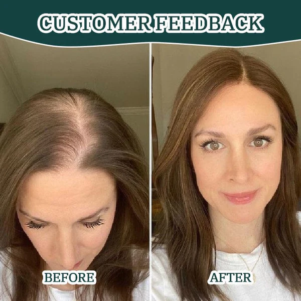 Biancat™ CentellaGrowth Scalp Scrub - Image 5