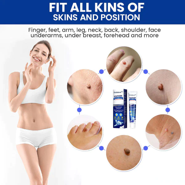 Dobshow™ WartsOff Rapid Creme zur sofortigen Entfernung von Hautunreinheiten - Image 6
