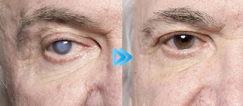 Bostore™ Myopia Reversal Eye Drops - Image 9