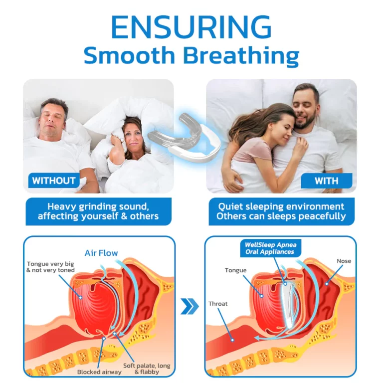 GFOUK™ WellSleep Apnea Oral Appliances - Image 6