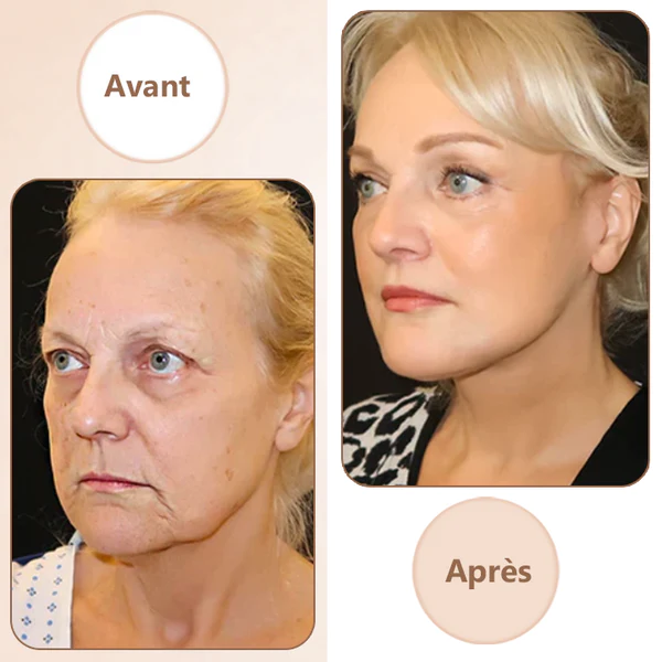 Oveallgo™ FirmLuxe Crème Magique Multi-Puissance Raffermissante - Image 10