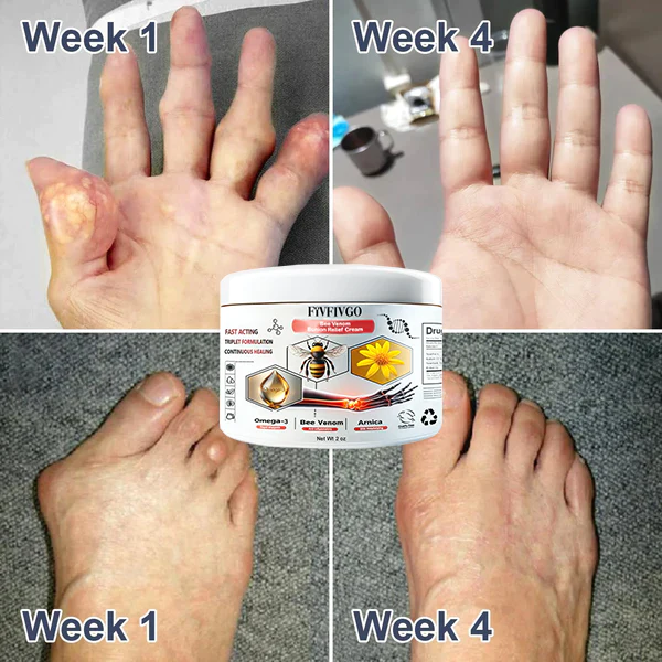 Fivfivgo™ Bienengift Ballenentzündung Creme - Image 8