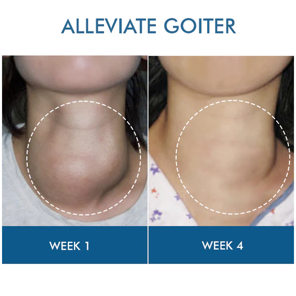Oveallgo™ Goiterless Neck Skin Firming Serum - Image 11