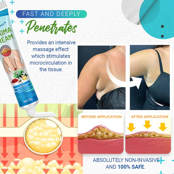 Cvreoz™Lipoma Removal Cream - Image 11