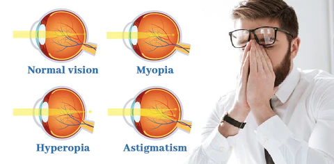 Bostore™ Myopia Reversal Eye Drops - Image 8