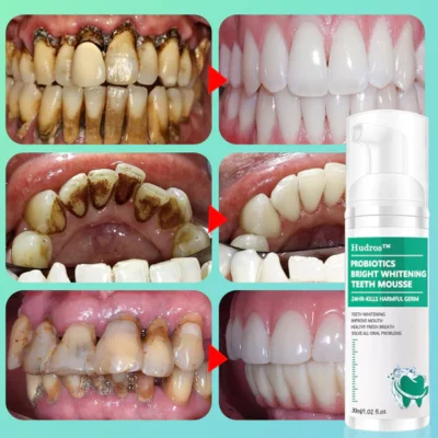 Hudros™ Herbal Brightening Oral Repair Mousse - Image 3