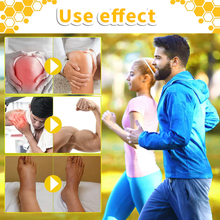 Aeehfeng™ Bee Venom Joint Therapy Pain Relief Gel - Image 6