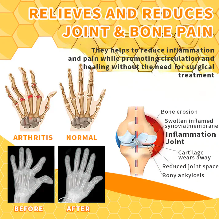Aeehfeng™ Bee Venom Joint Therapy Pain Relief Gel - Image 7