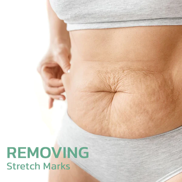 Nurbini™ Liquid Silk Body Essence Oil - Image 3