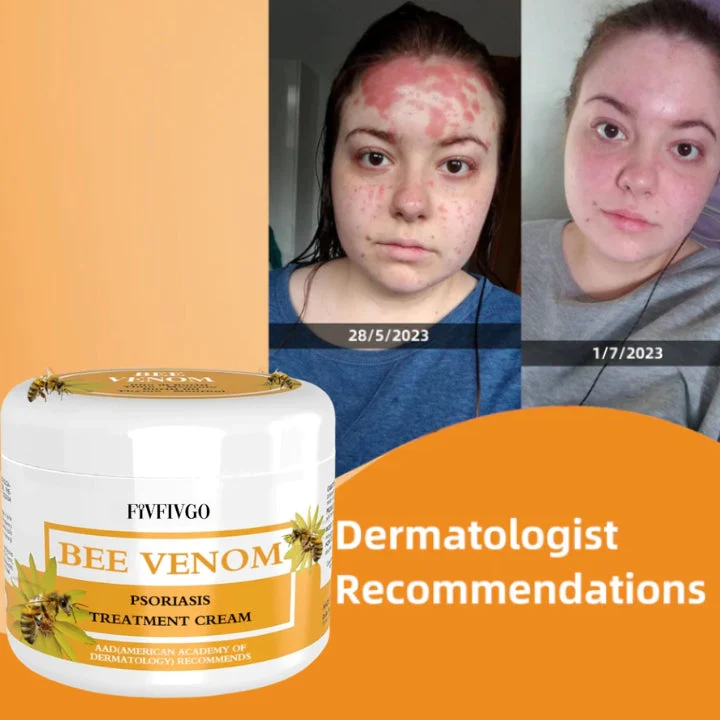 Fivfivgo™ BeeVenom Psoriasis-Lösungs-Creme - Image 2
