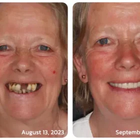 Furzero™ Natural Herbal Mouthwash - Image 5