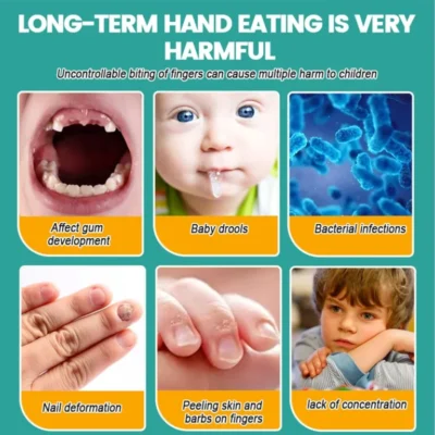 Nail Biting Treatment - Image 8