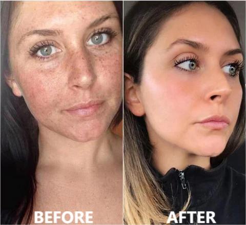 Luxury Collagen Boost Anti-Aging Serum For Remove 97% Deep Wrinkles & Dark Spots - Image 7