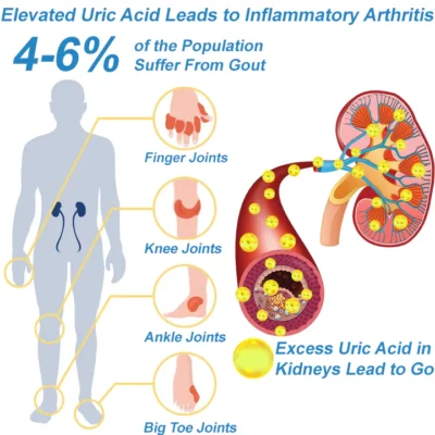 NORUION® Microcurrent EMS Therapy Bracelet - Image 4