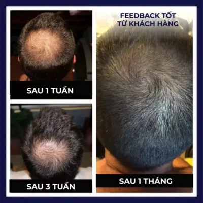 Natural Hair Regrowth Spray - Image 4