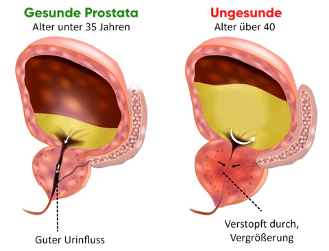 VitaCare™ Prostata-Behandlung Spray - Image 7