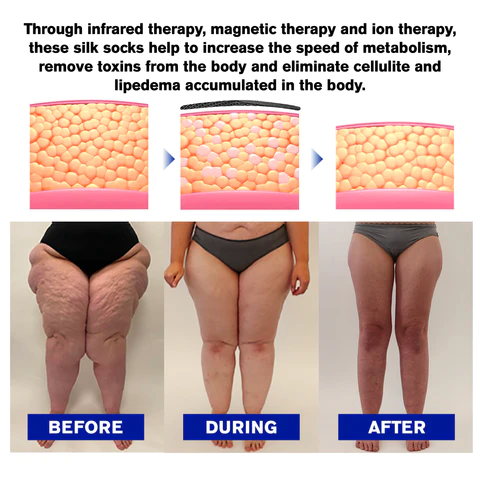AllyBee® LF-PEMF Bee Venom Lymphatic Detox & Fat Burning Socks - Image 3