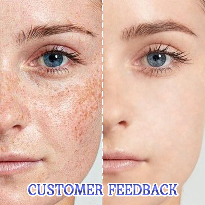 ATTDX Flawless Radiance Blemish Cream - Image 8