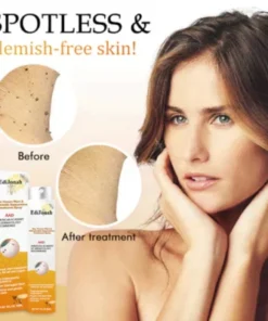 Primble™ Bee Venom Wart and Tags Removal Treatment Spray