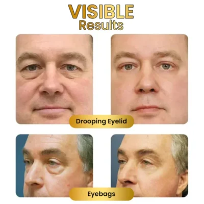 EyeRevive™ Firming Eye Cream - Image 10