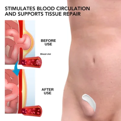 Oveallgo™ Inguinal Hernia Treatment Cream - Image 3