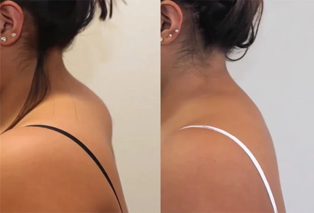 Ceoerty™ LymphCare Neck Therapy Device - Image 9