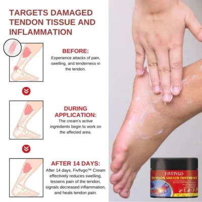 Fivfivgo™ Sehnen-Xanthomata Beruhigende Creme - Image 3