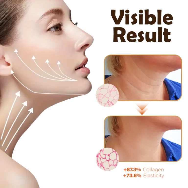 RICPIND Ultrasonic LiftBeauty Device with Serum - Image 7