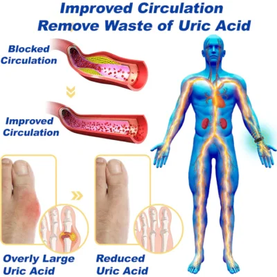 NORUION® Microcurrent EMS Therapy Bracelet - Image 5