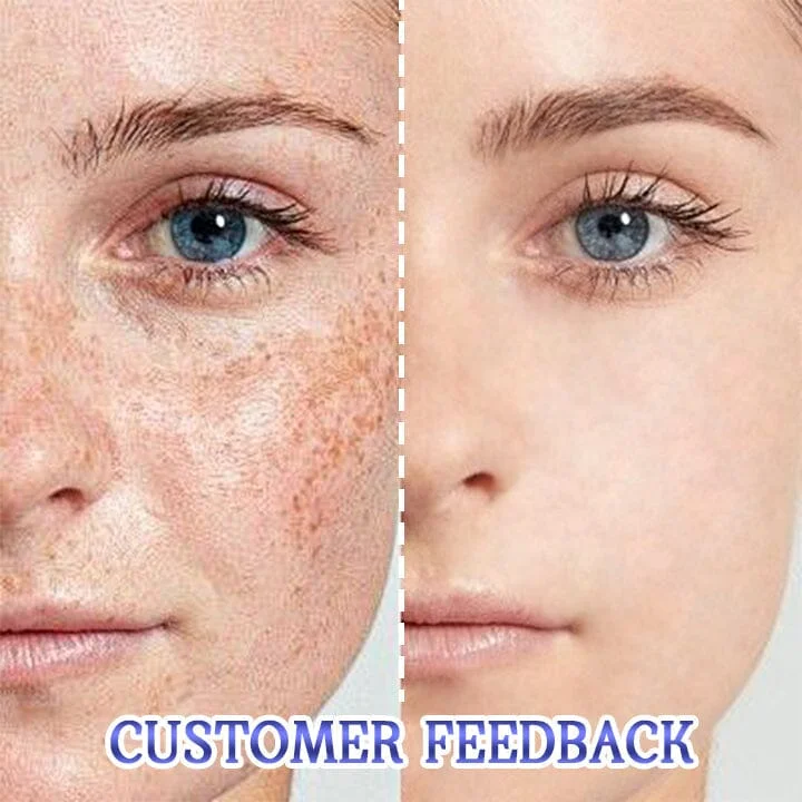 Biancat™ Flawless Radiance Blemish Cream - Image 7