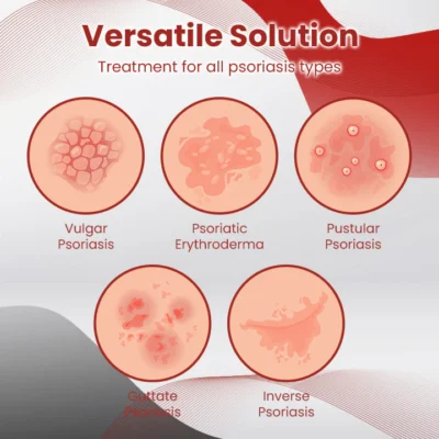 Ceoerty™ PsoriaCare Treatment Spray - Image 7