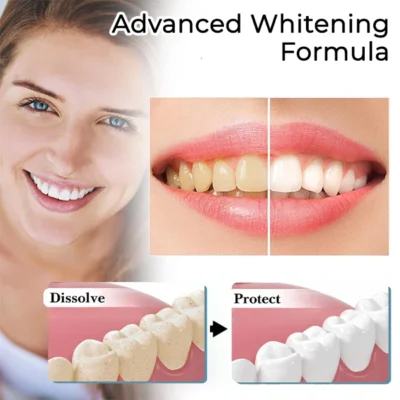 Fivfivgo™ Brilliance Soda Whitening Zahnpasta - Image 7