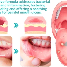 Furzero™ Natural Herbal Mouthwash - Image 3