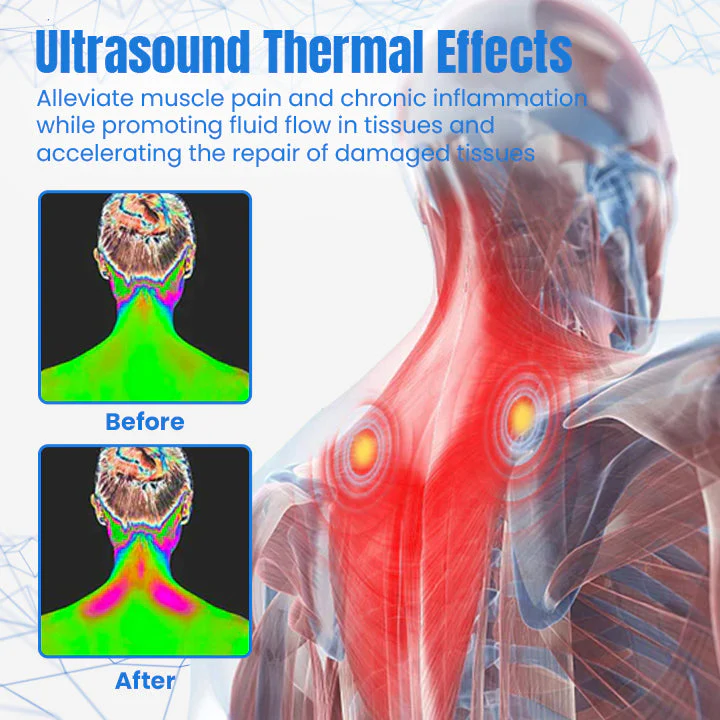 Ceoerty™ LymphCare Neck Therapy Device - Image 5