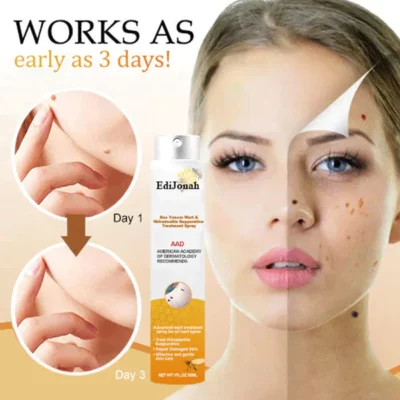 Primble™ Bee Venom Wart and Tags Removal Treatment Spray - Image 2