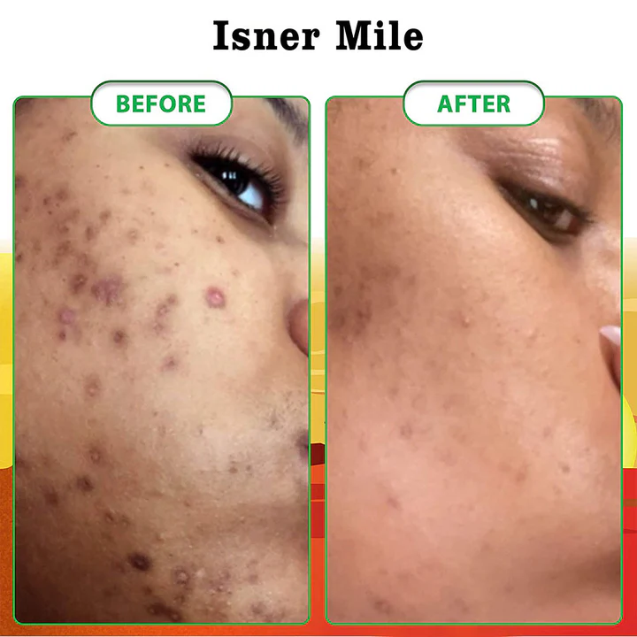 Zakdavi™ Natural Radiance Combo - Image 5