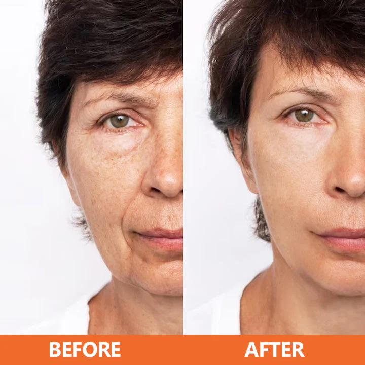 LIMETOW™ Vitamin C Anti-Aging Serum - Image 8