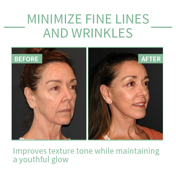 Luxury Collagen Boost Anti-Aging Serum For Remove 97% Deep Wrinkles & Dark Spots - Image 3