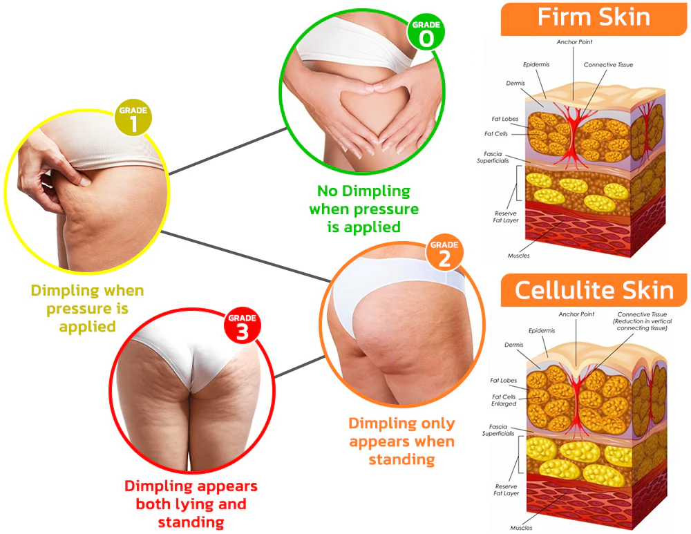 GFOUK™ LymFatTake Orange Blossom Slender Patch - Image 9