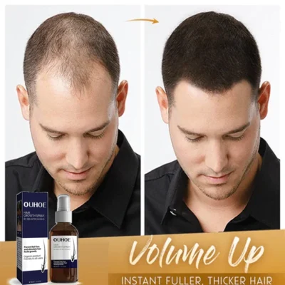 Natural Hair Regrowth Spray - Image 5