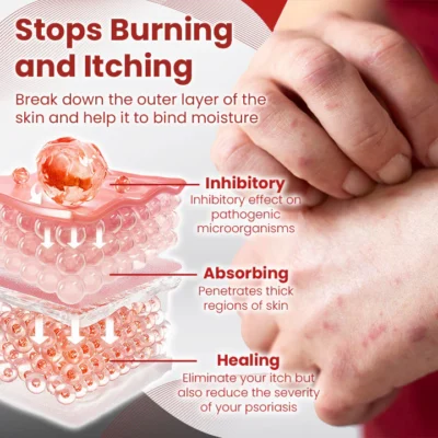 Ceoerty™ PsoriaCare Treatment Spray - Image 3