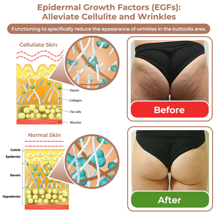 flysmus™ CurvesSculptor Enhancement Patch - Image 5