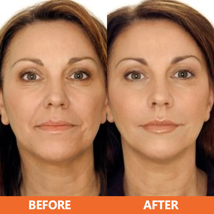 LIMETOW™ Vitamin C Anti-Aging Serum - Image 7