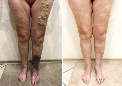 AllyBee® LF-PEMF Bee Venom Lymphatic Detox & Fat Burning Socks - Image 8