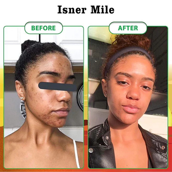 Zakdavi™ Natural Radiance Combo - Image 3