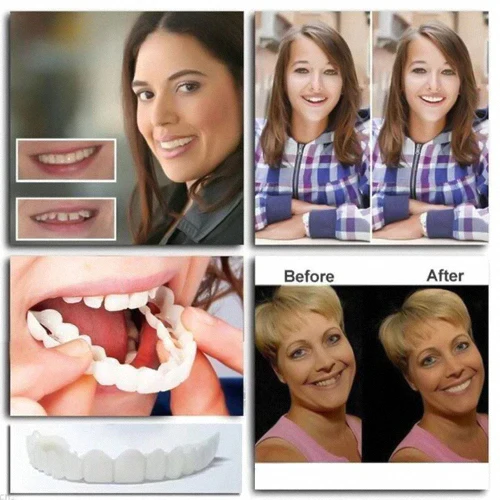 Dobshow™ ProX adjustable snap-on dentures - Image 6