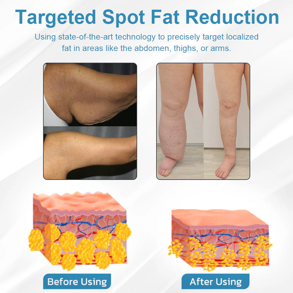 PAROWU TENS Spine Nerve Massager - Image 3